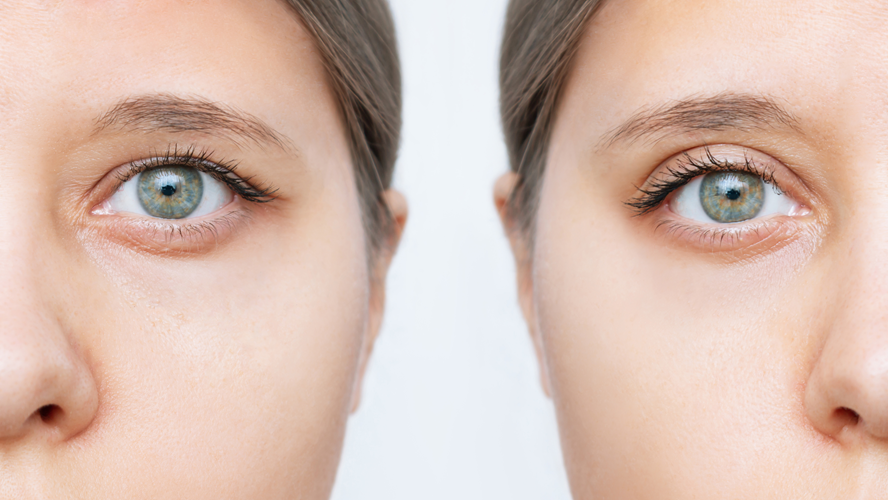 Cosmetic & Reconstructive Surgery on the eye