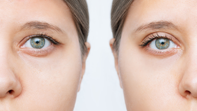 Cosmetic & Reconstructive Eye Surgery - Eyecare Services